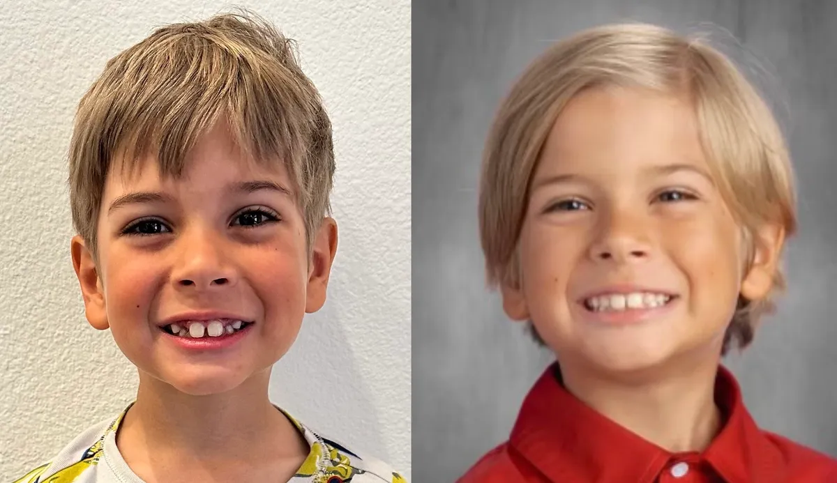 Side-by-side before and after of our son after six months on the Toothpillow program, visible change in facial development