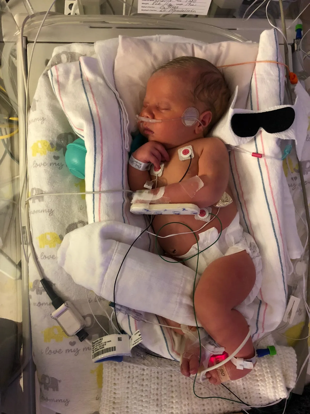 Our son in the NICU in his earliest days, when preventative antibiotics were part of his care