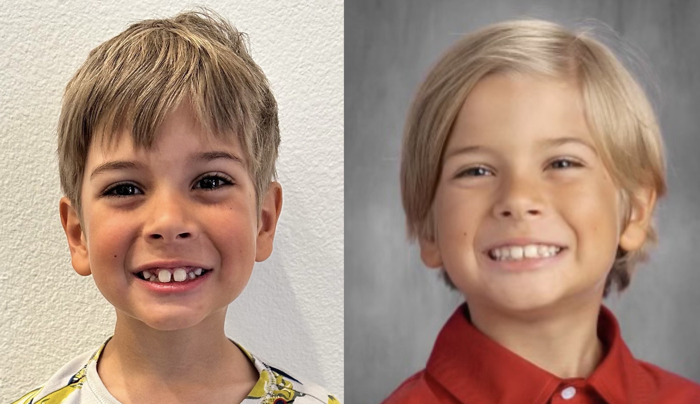 Side-by-side before and after of our son after six months on the Toothpillow program, visible change in facial development