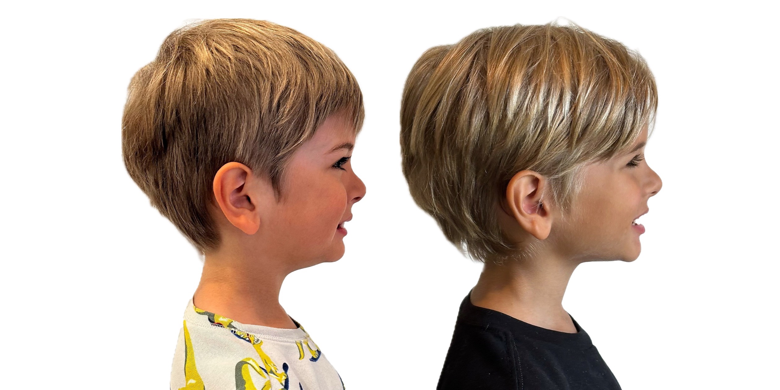 Our son before and after, just four months on the Toothpillow program