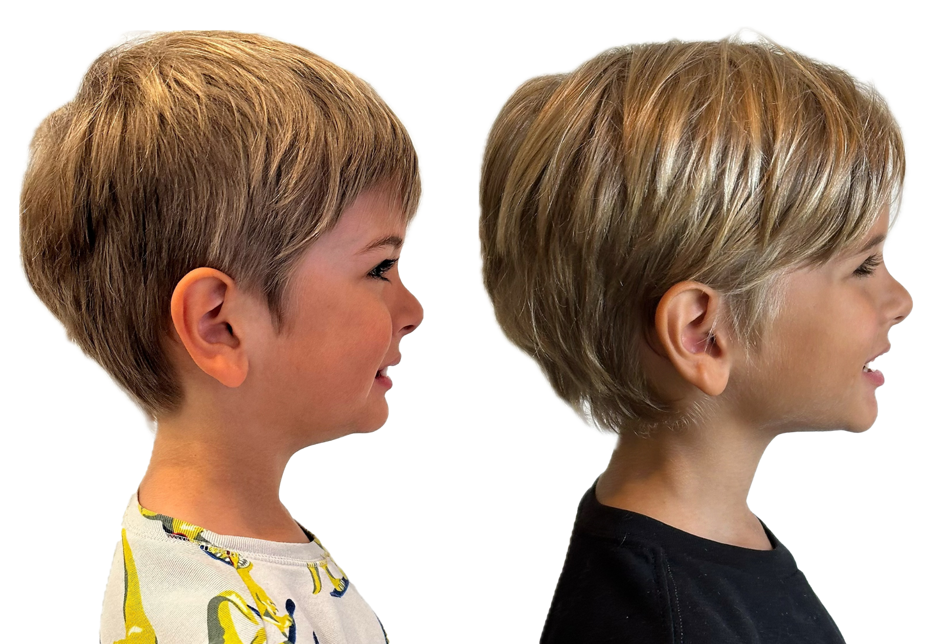 Our son before and after, just four months on the Toothpillow program